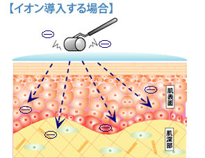 イオン導入する場合